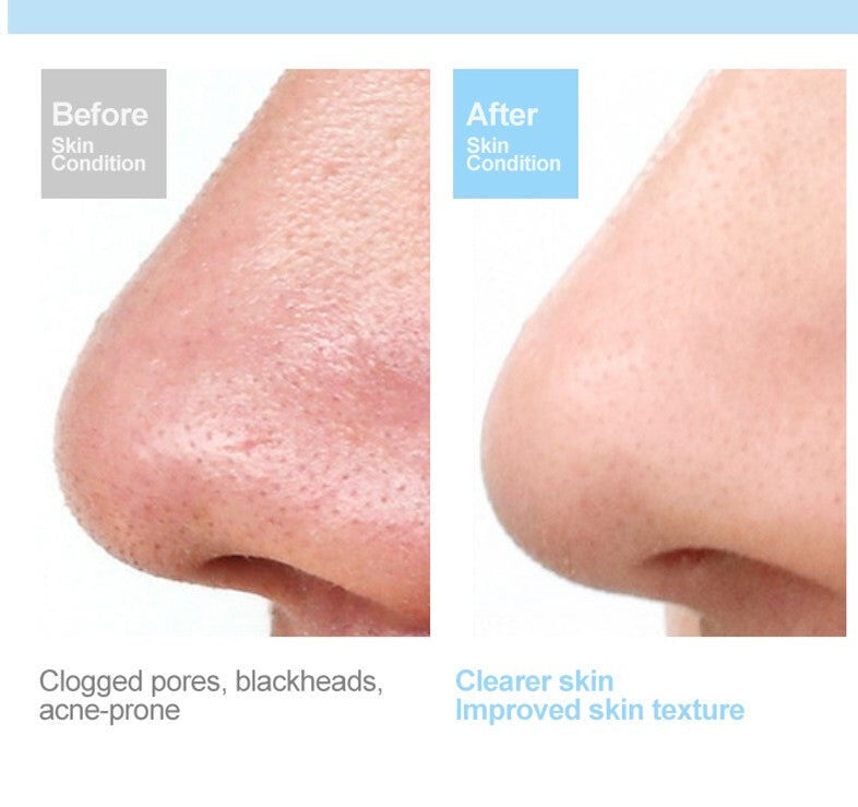 Prospera Hot compress red blue light cleansing massager, PRINK, alternate image number 7