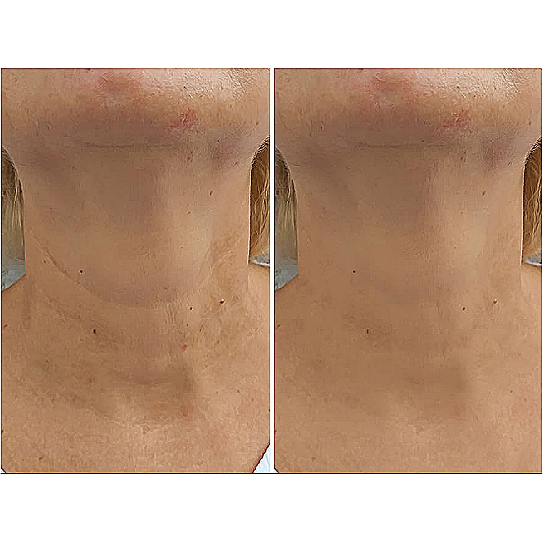 30 Second Lift Beauty Tools, , alternate image number 4