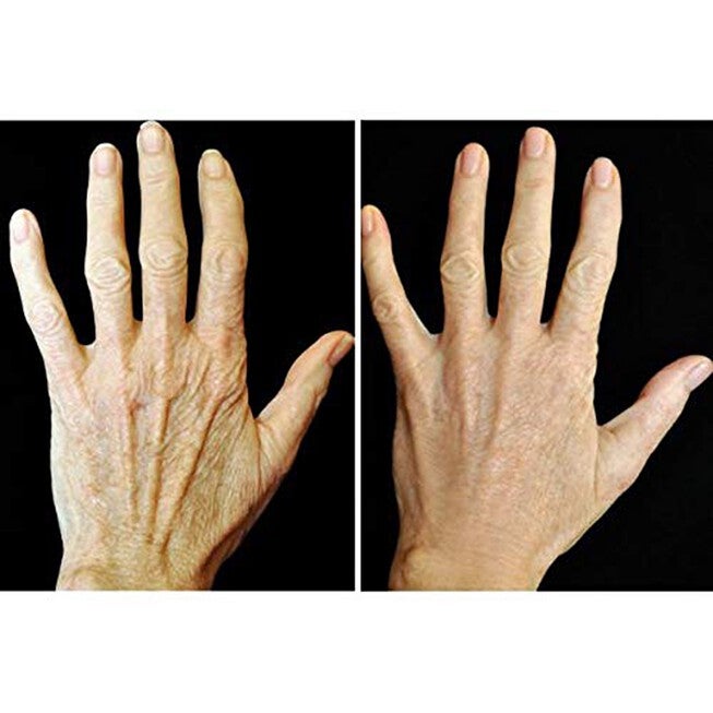 Crepe Gone Facial Souffle Anti Aging Skin Cream Beauty Tools, , alternate image number null