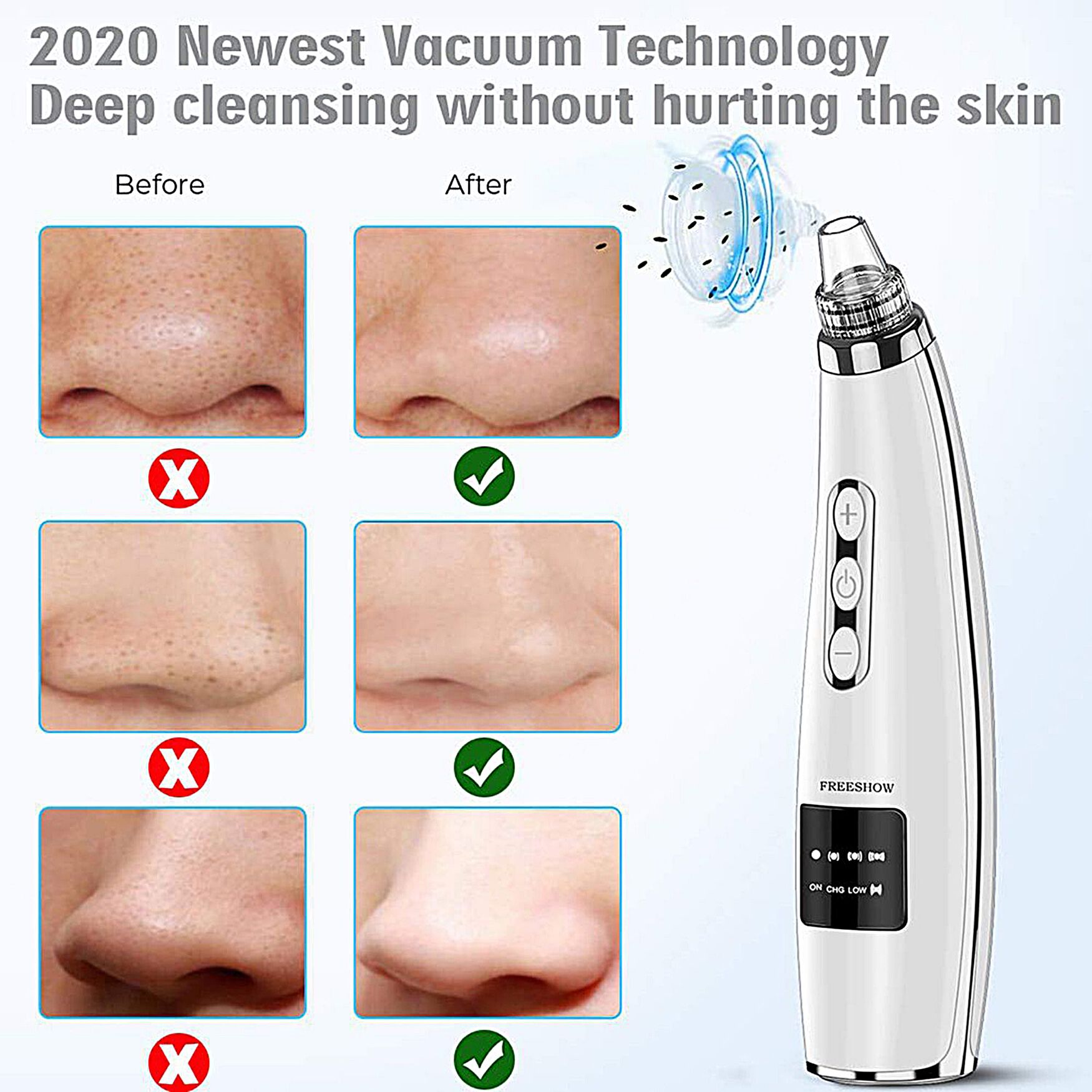 Vacuum Pressure Suction Pore Cleanser Beauty Tools, , alternate image number 2