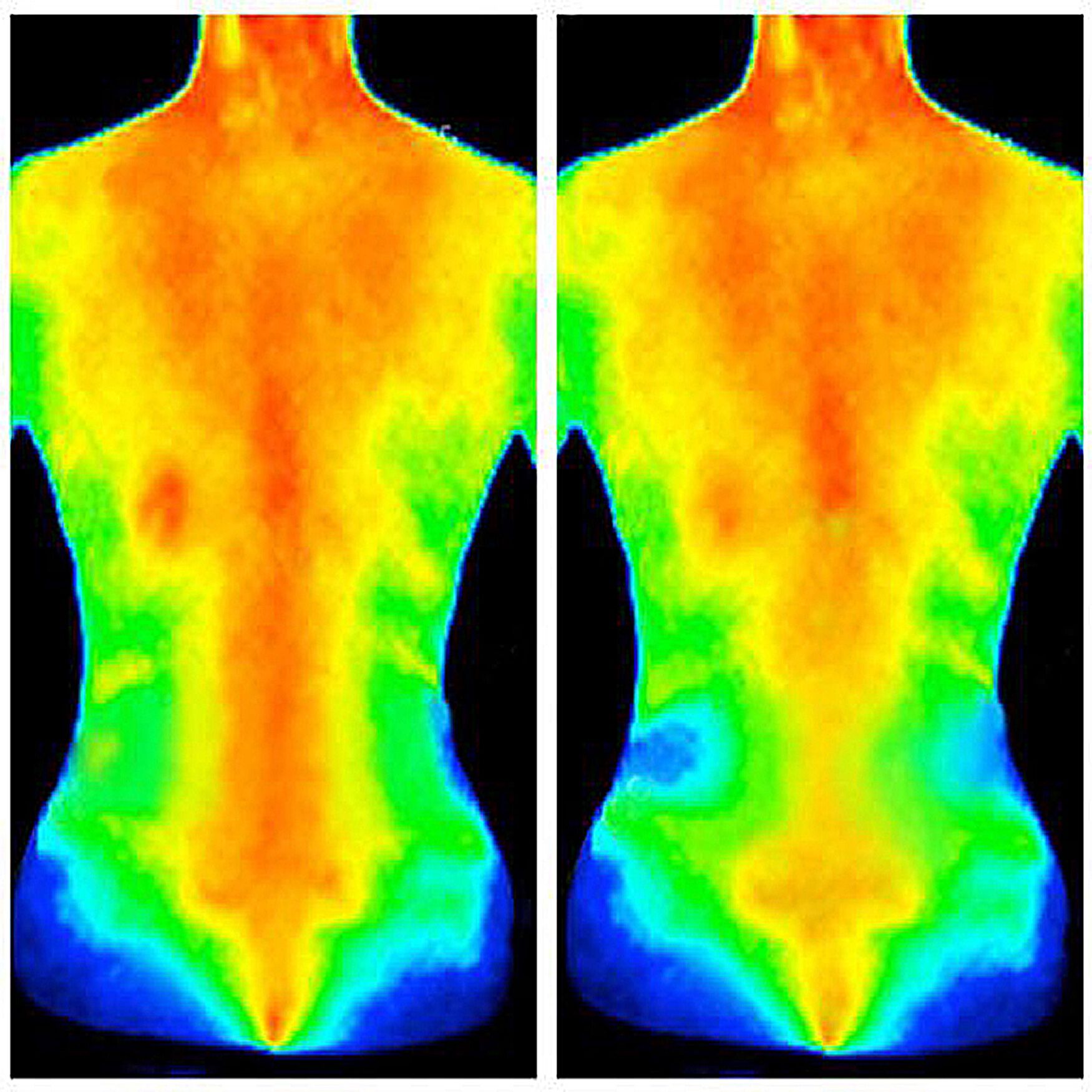 Therafreeze Ice Cold Therapy Wellness, , on-hover image number 1